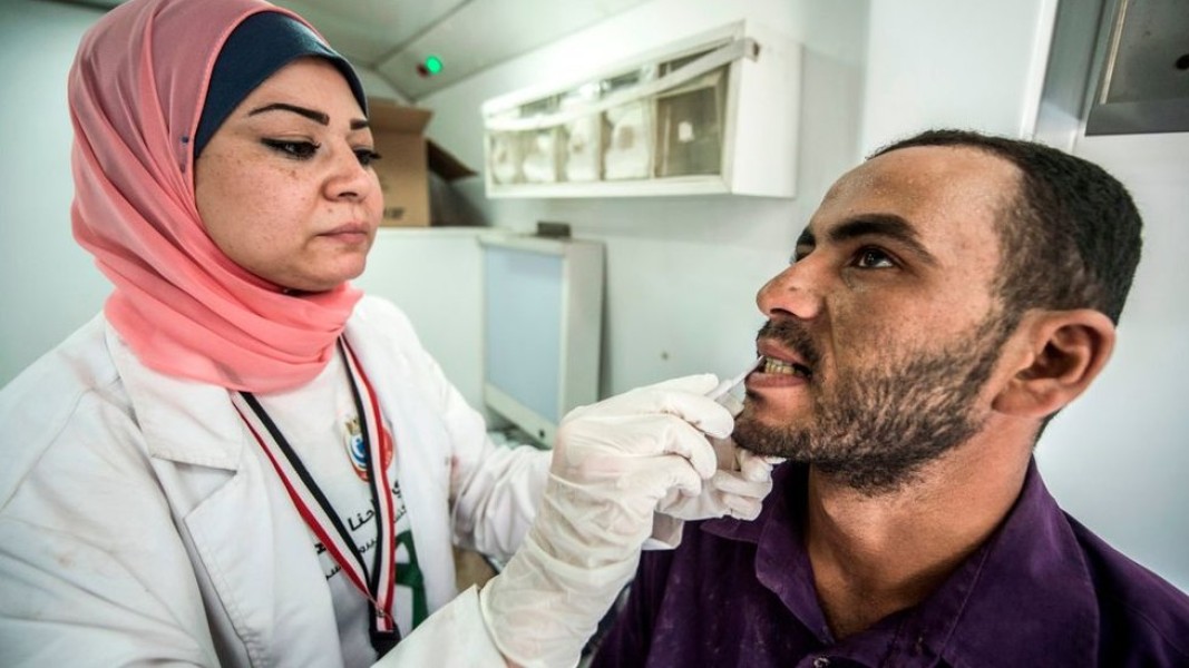 Ini Penjelasan Dokter: Kasus Hepatitis Aceh Terus Meningkat