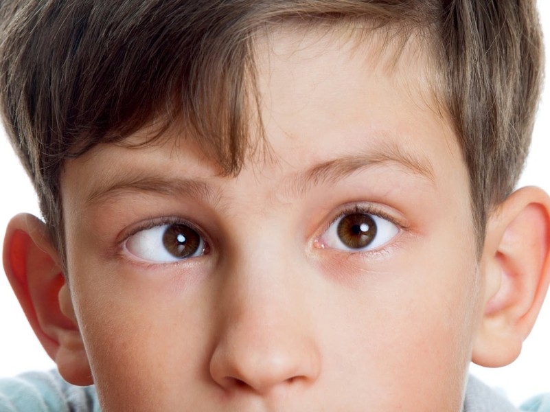 Terapi Mata Juling tanpa Operasi, Prosedur, dan Biayanya