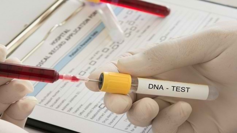 Harga Tes DNA di Rumah Sakit dan Puskemas hingga Prosedurnya