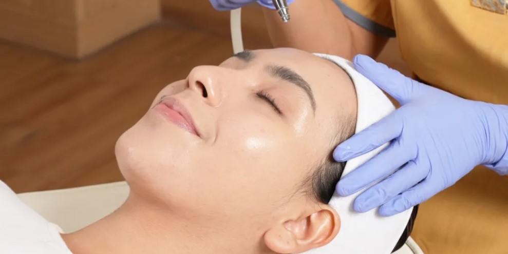 Perawatan Exion di Dermalogia untuk Kulit Glowing Tanpa Jarum