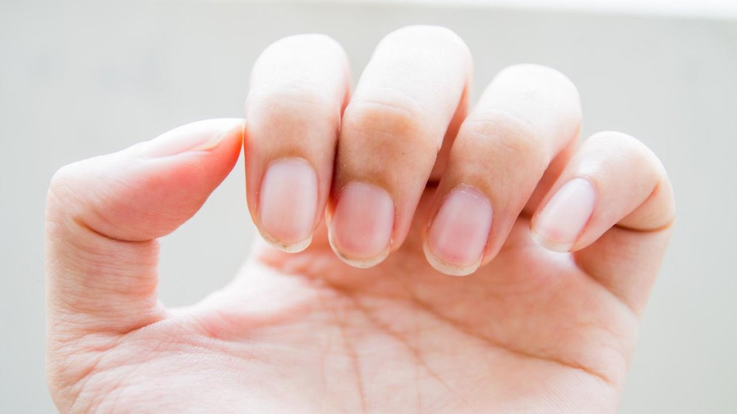 Tanda Kesehatan Tubuh Melalui Perubahan pada Kuku Manusia