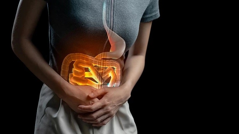 Waspada Pola Makan Modern, Ancaman Kesehatan dari Kanker Usus pada Generasi Muda