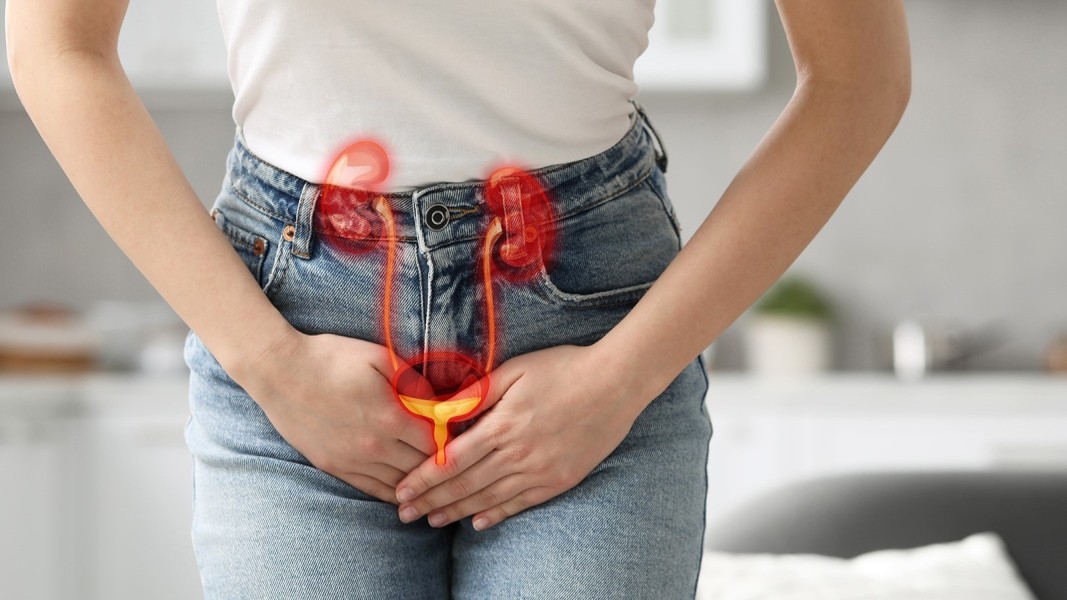 Waspadai Gejala Infeksi Saluran Kemih Sebelum Menyebar ke Ginjal