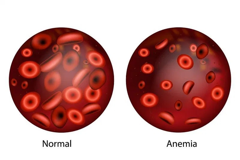 Gaya Hidup Modern yang Diam-Diam Menjadi Pemicu Diabetes