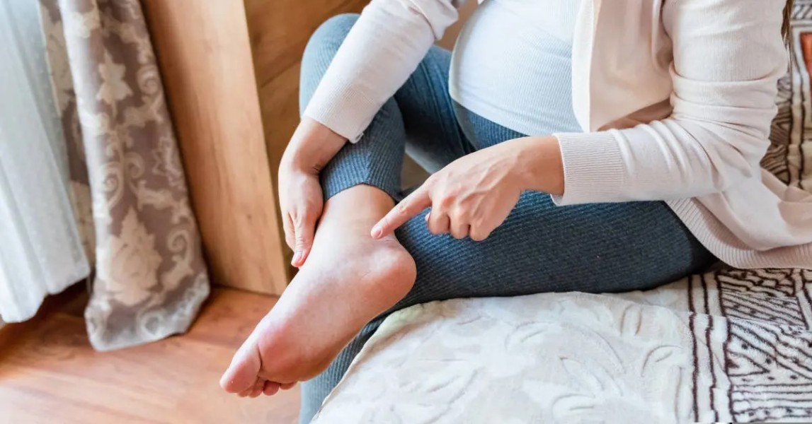 Cara Aman Mengatasi Kaki Bengkak Saat Hamil Agar Nyaman Selalu