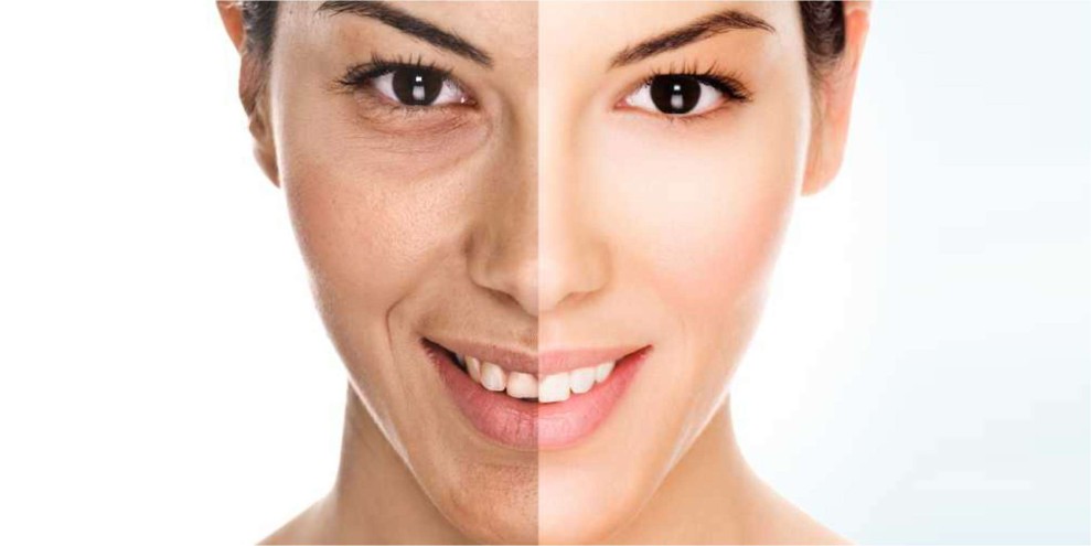 Waspada Sejak Dini, Inilah Makanan Sehari-hari yang Bisa Mempercepat Penuaan Kulit