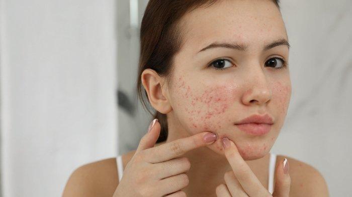 Tanda Kulitmu Butuh Dokter, Bukan Produk Skincare Baru