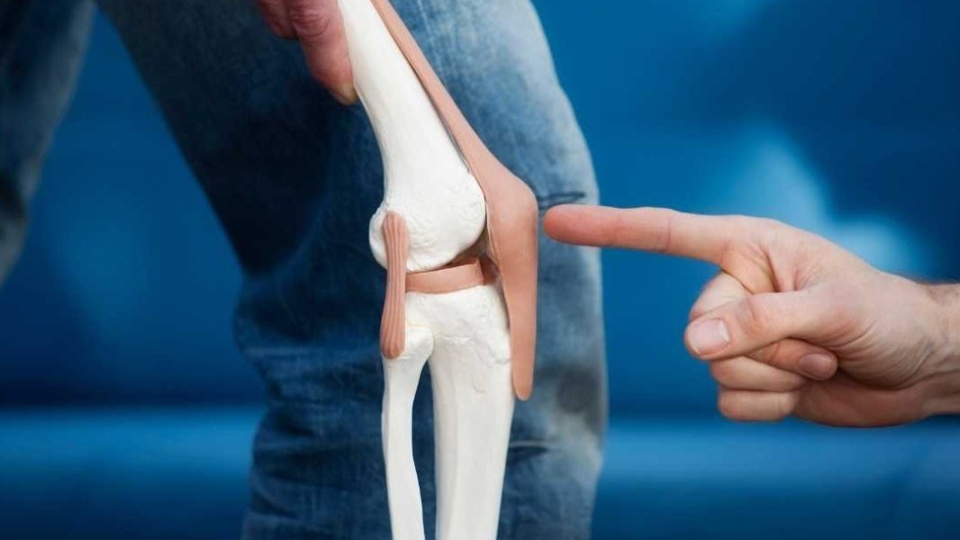 Cara Tepat Mencegah dan Mengurangi Risiko Pengapuran Tulang Sejak Dini