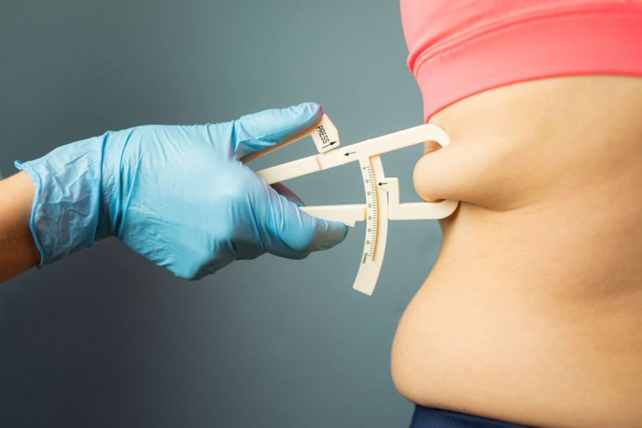 Cara Mengatasi Obesitas Secara Alami dan Aman Tanpa Obat