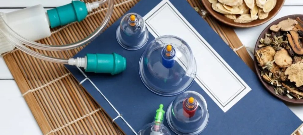 5 Manfaat Bekam Secara Alami Mengatasi Berbagai Masalah Kesehatan Tubuh