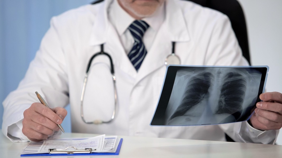 Perbedaan Asma pada Anak dan Dewasa: Penjelasan Lengkap dari Dokter Spesialis Paru