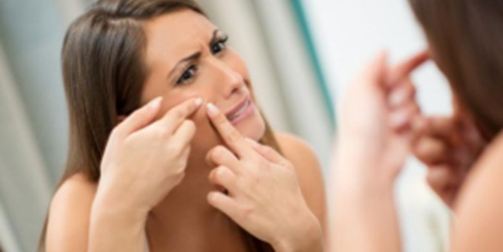 Ini 9 Cara Mengatasi Jerawat Batu Secara Alami dan Medis