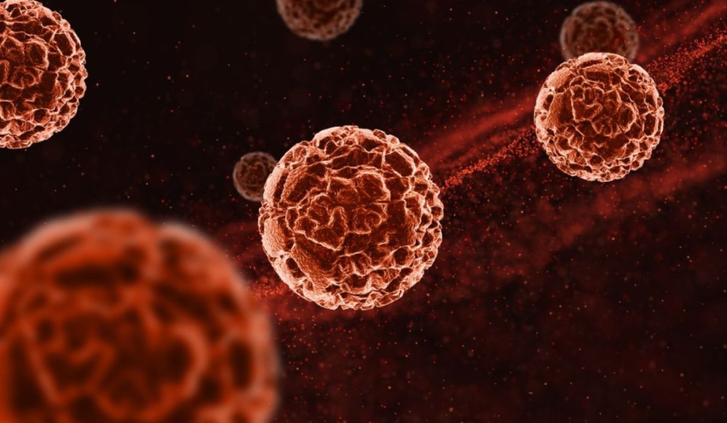 Jenis-jenis Tumor Jinak dan Ganas serta Biaya Pemeriksaannya