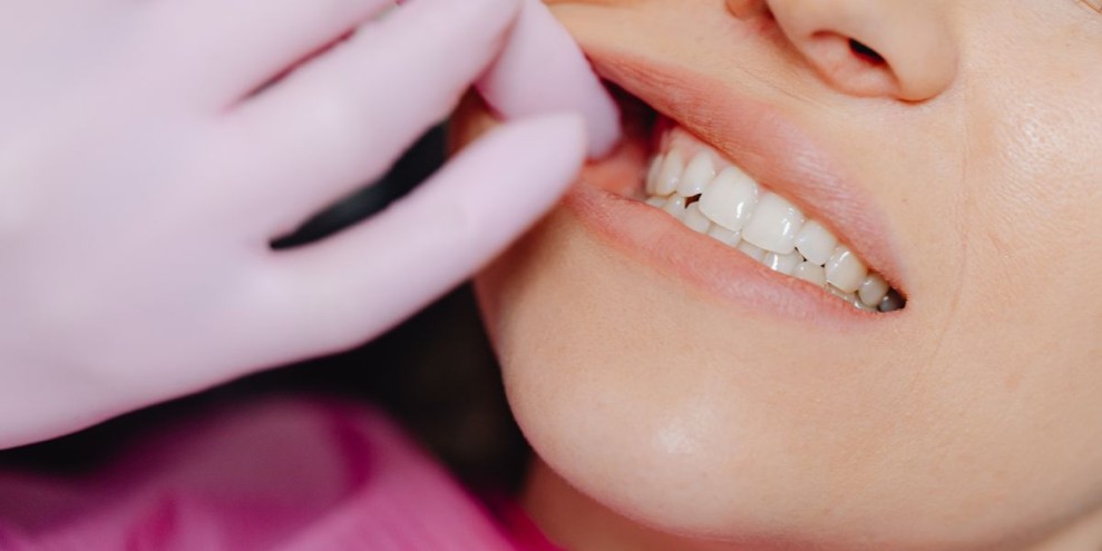 7 Cara Mencegah Gigi Berlubang agar Terhindar dari Beragam Penyakit