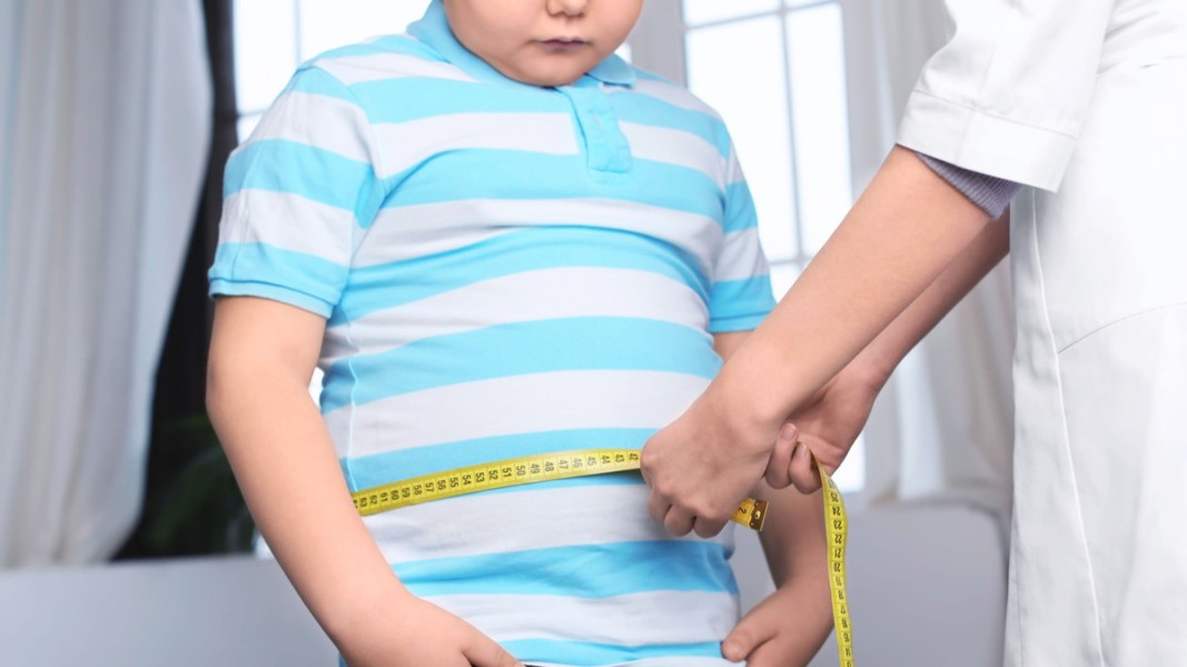 Kemenkes Gencar Cegah Obesitas Anak Sejak Dini