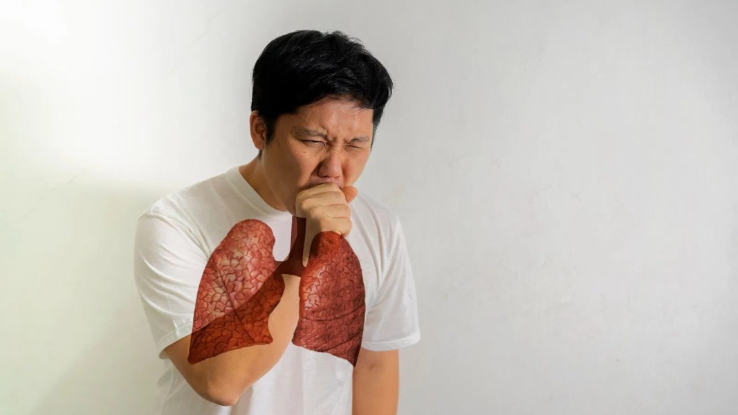 Panduan Lengkap Strategi Melindungi Tubuh dari Pneumonia yang Menular