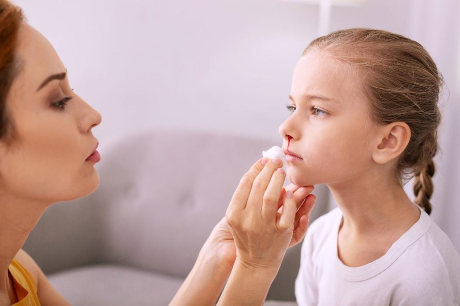 Tips Dokter Atasi Mimisan Anak