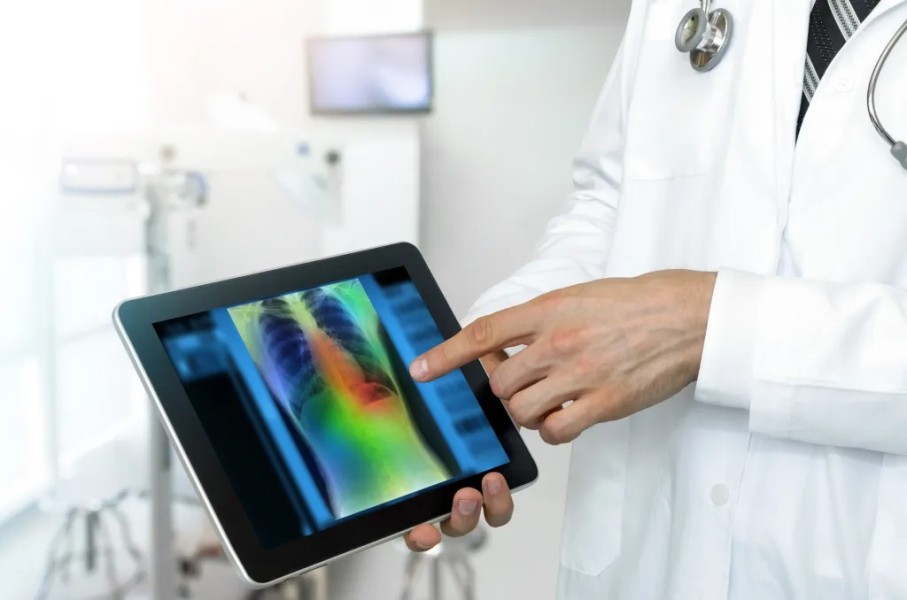 Philips Soroti Peran AI dalam Industri Kesehatan Indonesia