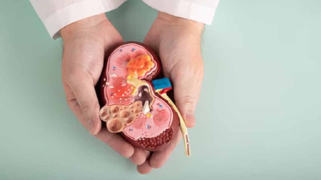 5 Kebiasaan Pagi Sepele yang Diam-Diam Bisa Merusak Kesehatan Ginjal Anda