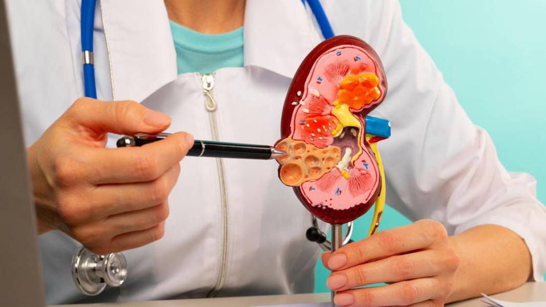 Cara Menjaga Kesehatan Ginjal Selama Puasa Ramadan Agar Tubuh Tetap Optimal