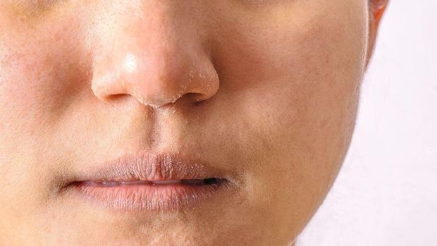 7 Tanda Tubuh Kekurangan Lemak Perlu Diwaspadai