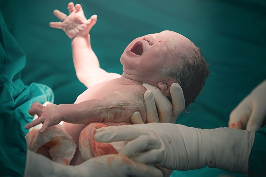 6 Manfaat Persalinan Normal bagi Ibu dan Bayi Secara Fisiologis