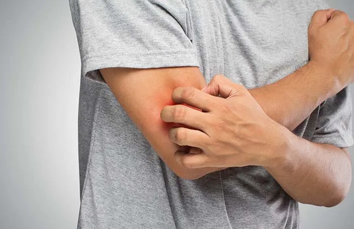 Kulit Sering Gatal dan Tidak Membaik? Bisa Jadi Ini Penyebabnya