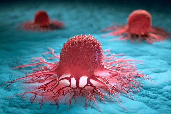 Kasus Kanker di Indonesia Diprediksi Meningkat Drastis pada 2050, Kemenkes Anjurkan Perkuat Deteksi Dini