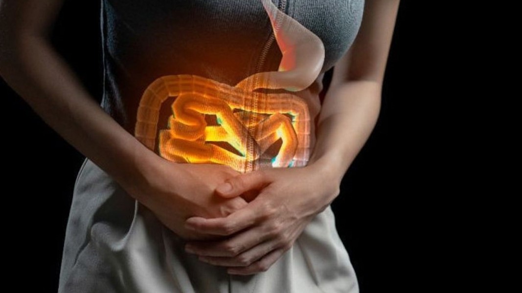 Riset Baru Menyoroti Pemicu Kanker Usus yang Sering Diabaikan Generasi Muda