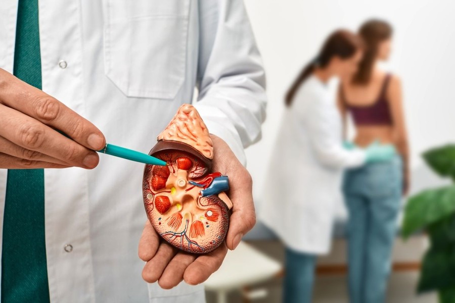 Dokter Ungkap Usia Paling Banyak Pasien Batu Ginjal di Indonesia