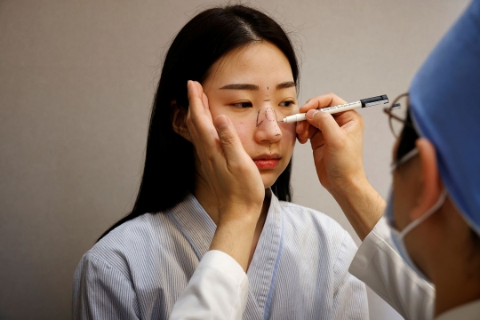 Operasi Plastik Korea Memiliki Fenomena, Prosedur, dan Dampaknya