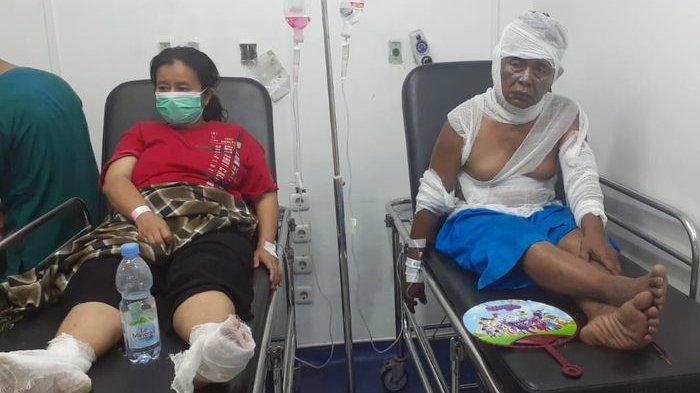 Gas Bocor Meledak di Cakung, Seorang Pria Alami Luka Bakar di Wajah